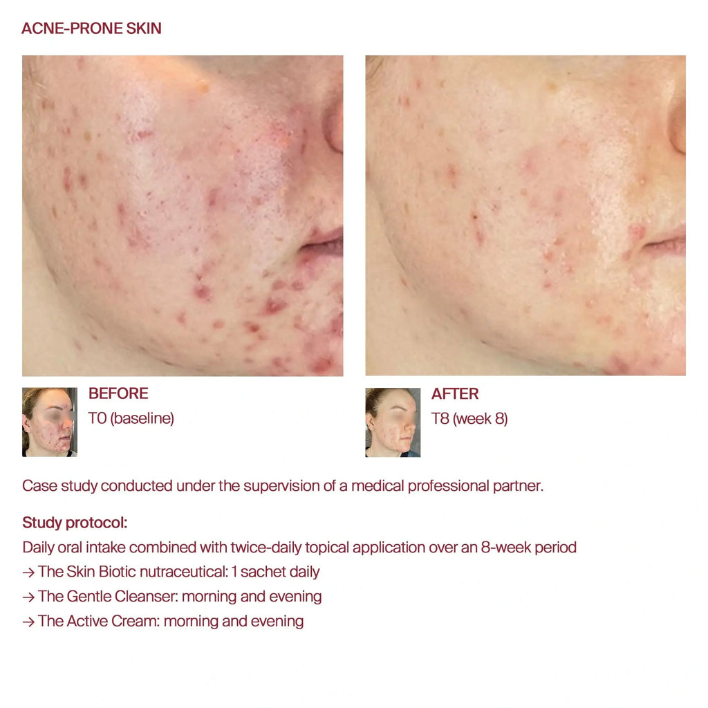 AWvi The Skin Biotic (30 x 1g)