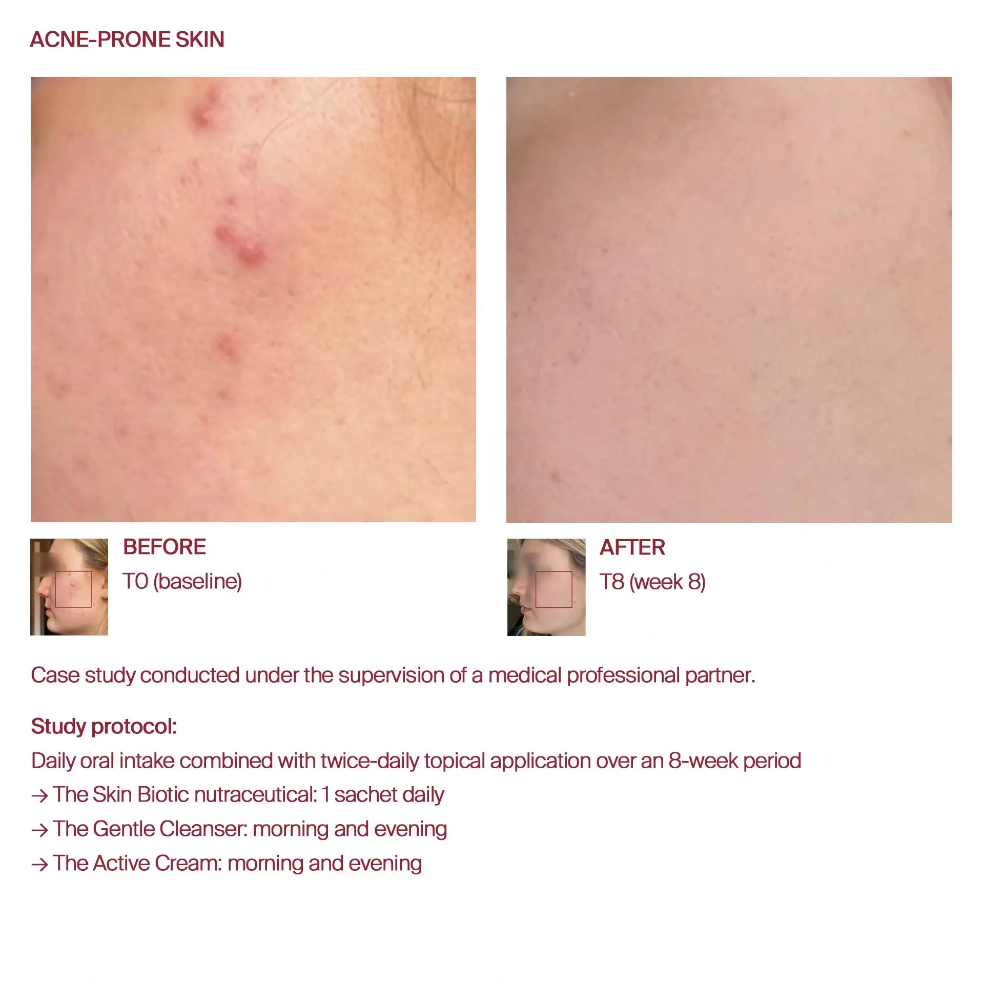 AWvi The Gentle Cleanser (1 x 100ml)