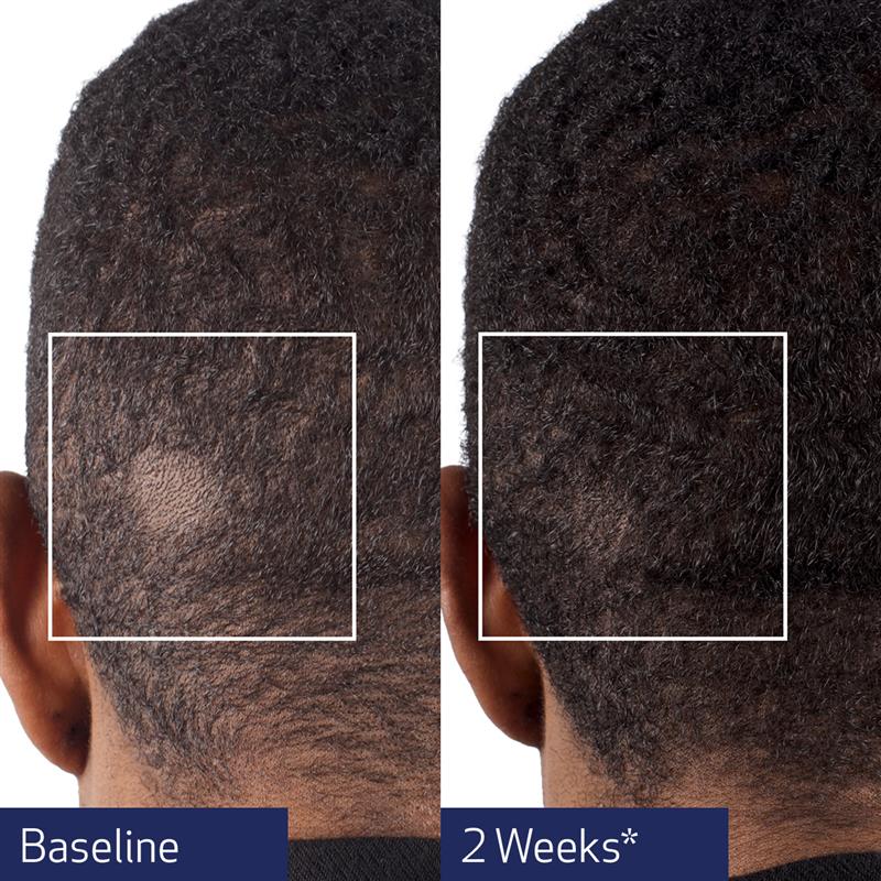 Obagi Nu-Cil® BioStim™ Scalp Serum
