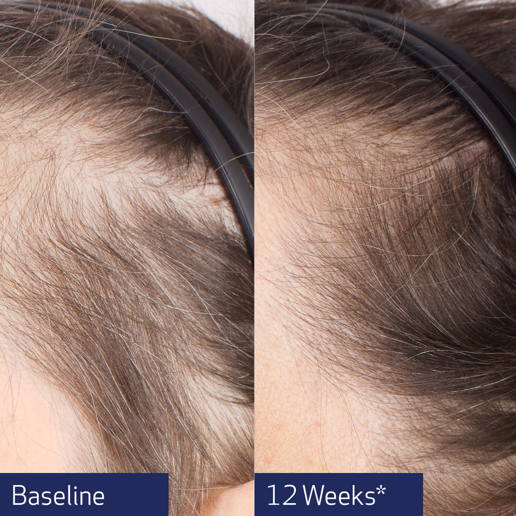 Obagi Nu-Cil® BioStim™ Scalp Serum