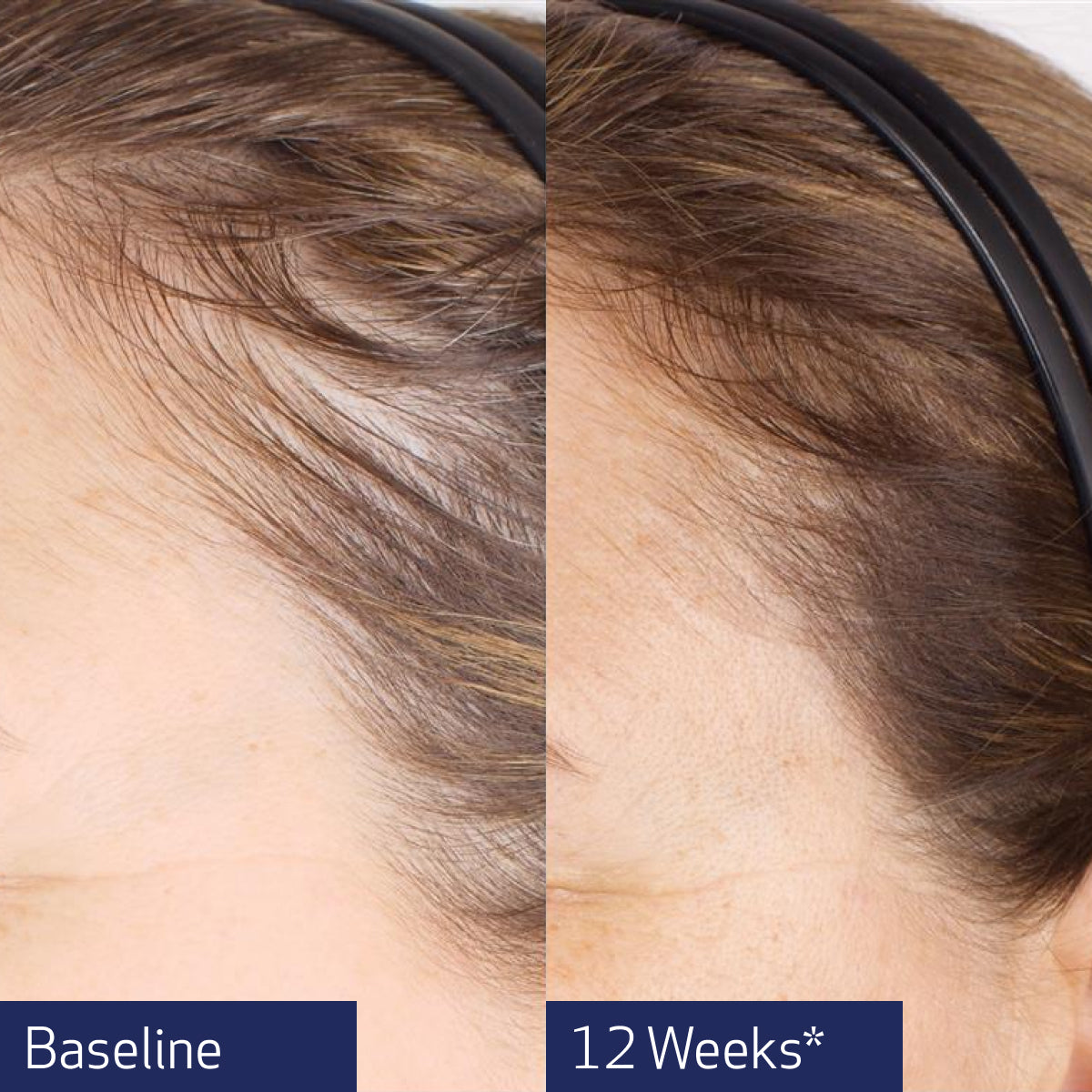 Obagi Nu-Cil® BioStim™ Scalp Serum