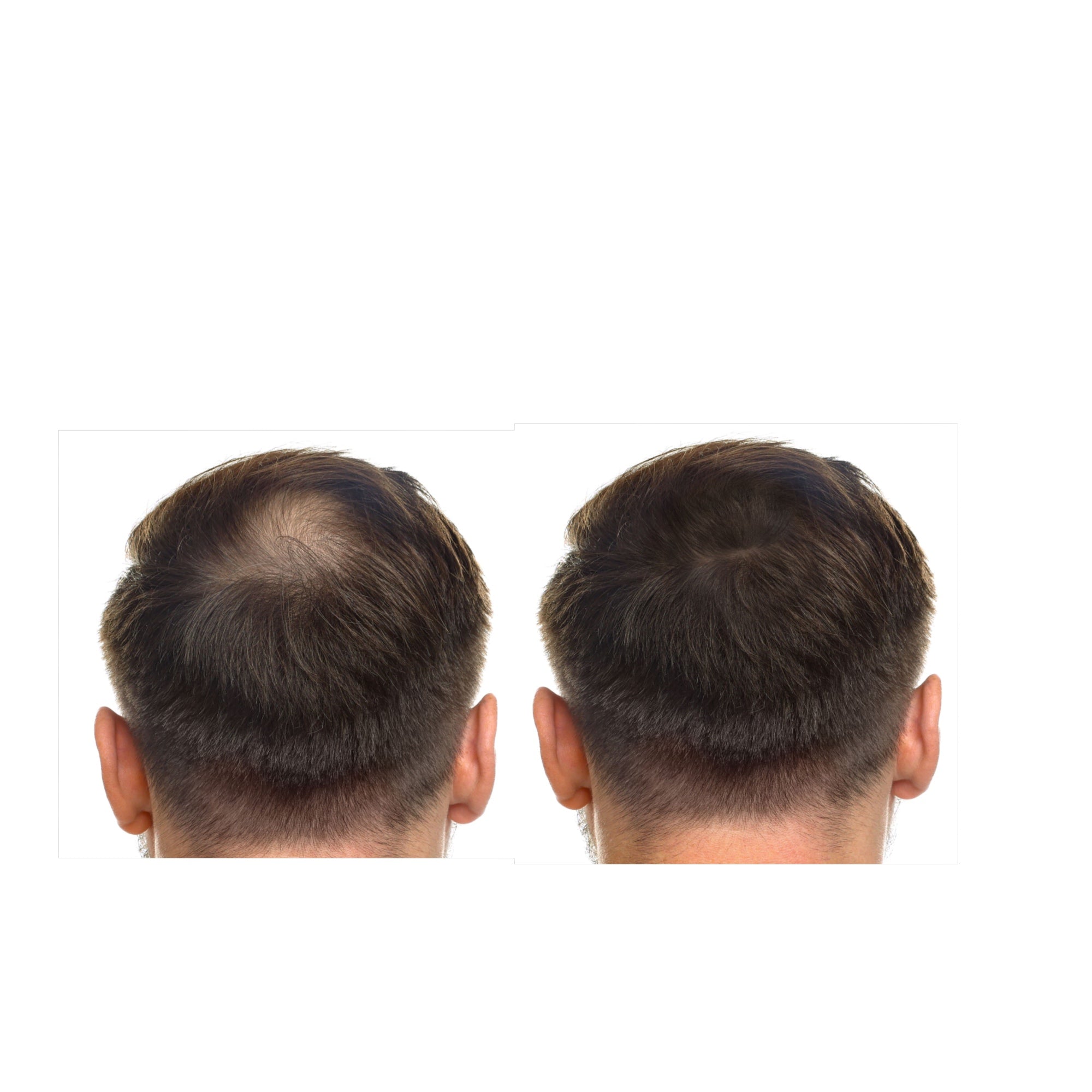 Regaine Extra Strength Scalp Foam