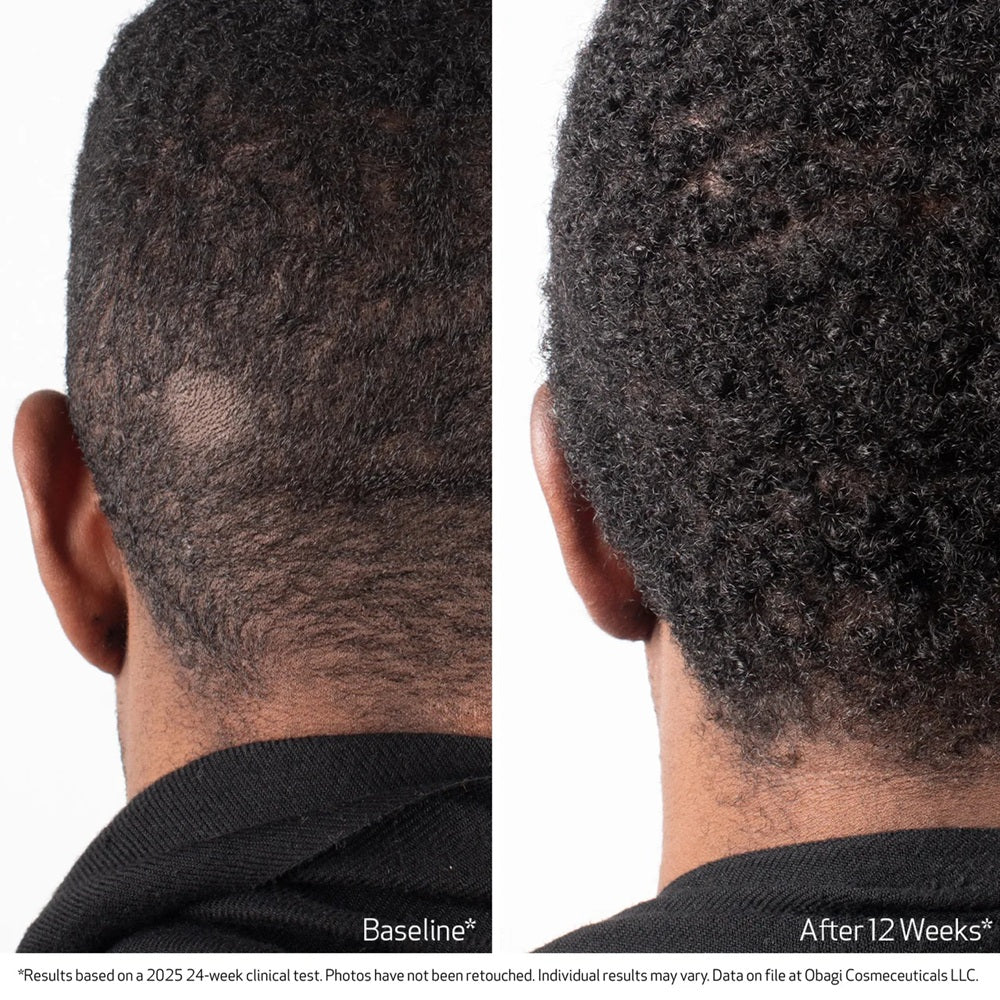 Nu-Cil® BioStim™ Scalp Serum