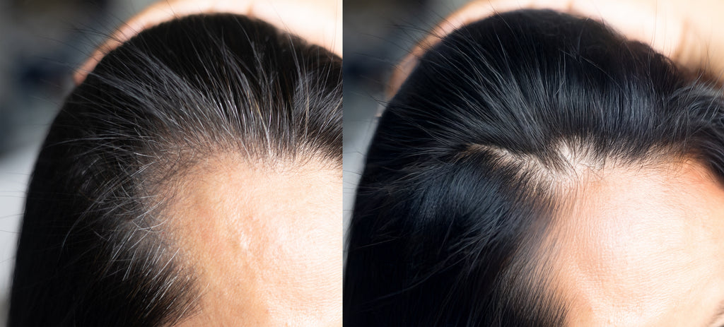 Hair Loss Solutions